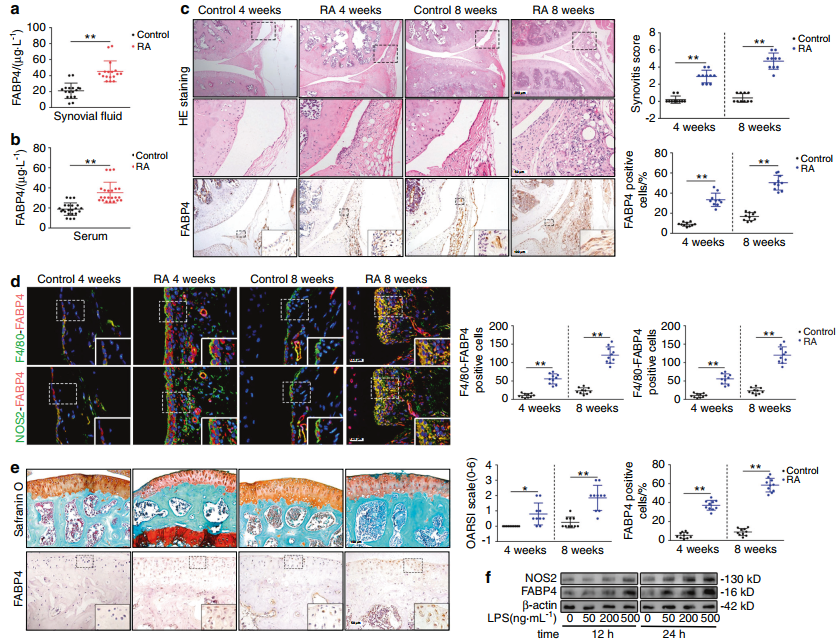 Bone Research | 类风湿性关节炎潜在治疗靶点新发现 