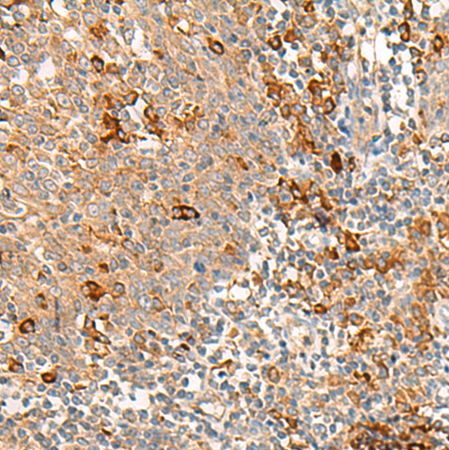 兔抗RNF207多克隆抗体