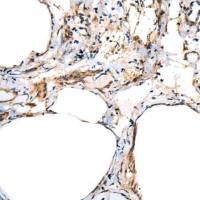 兔抗FSD1L多克隆抗体