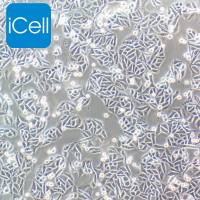 SW480 人结肠腺癌细胞/SW480/SW480细胞/SW-480/SW-480细胞/STR鉴定