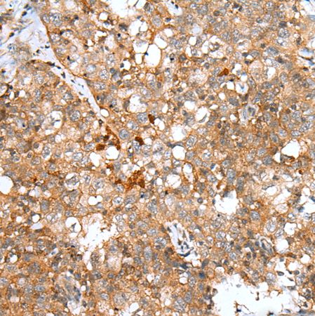 兔抗DCX多克隆抗体