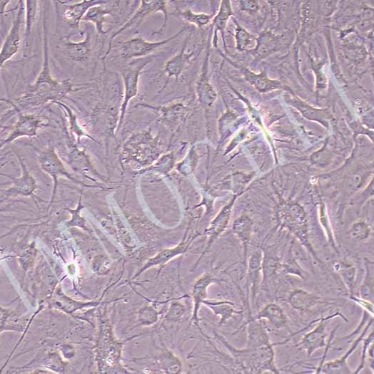 PVIC-HTERT人瓣膜间质细胞永生化丨PVIC-HTERT细胞