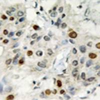 兔抗AFF1多克隆抗体