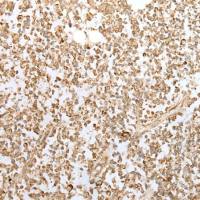 兔抗ZKSCAN1多克隆抗体