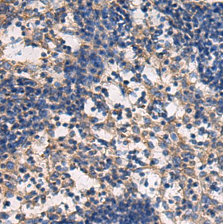 兔抗DMRTA2多克隆抗体