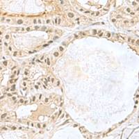 兔抗KDM3B多克隆抗