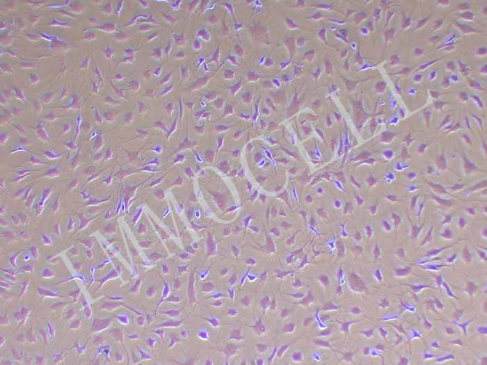 PVIC-HTERT人瓣膜间质细胞永生化丨PVIC-HTER