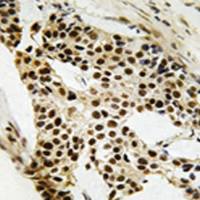 兔抗MAPKAPK2(Ab-272) 多克隆抗体