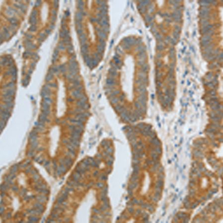 兔抗DNAJC10多克隆抗体