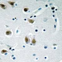 兔抗ZNF148多克隆抗体