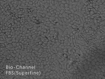 HacaT细胞培养建议（杭州昊鑫生物）