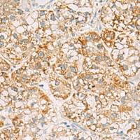 兔抗SH3YL1多克隆抗体