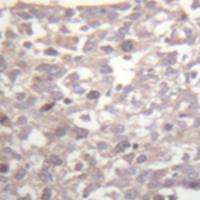 兔抗TUBG1多克隆抗体