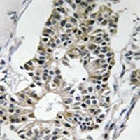 兔抗RIMS4多克隆抗体