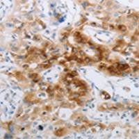 兔抗NPY2R多克隆抗体