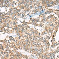 兔抗YEATS2多克隆抗体