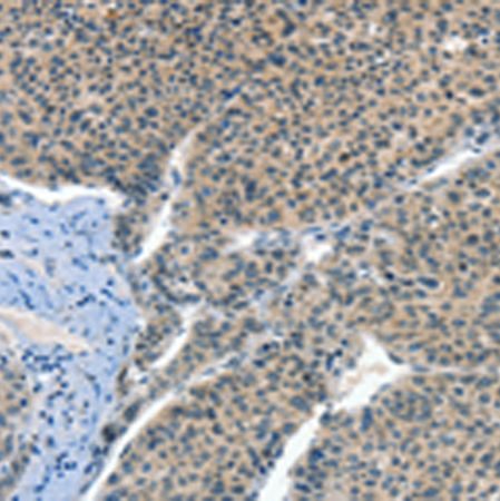 兔抗CRLF2多克隆抗体