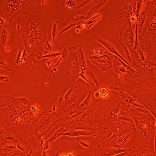 THLE-2人肝永生化细胞丨THLE-2细胞株