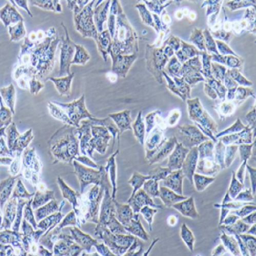 HPV16，E6,E7和ras基因共转化的C57BL/C(H-2b)小鼠肺上皮细胞,TC-1细胞