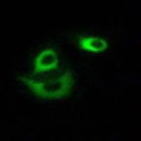 兔抗CLCC1多克隆抗体