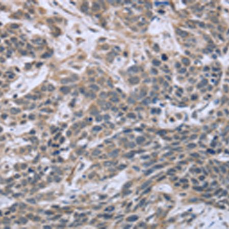 兔抗ESR2多克隆抗体