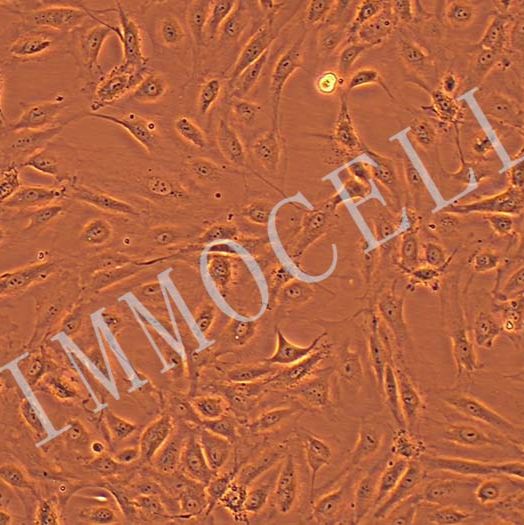 人淋巴管内皮细胞永生化细胞 丨人源细胞株