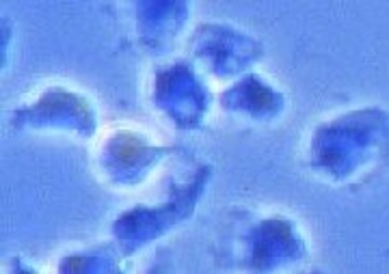 CD105 MicroBeads, human