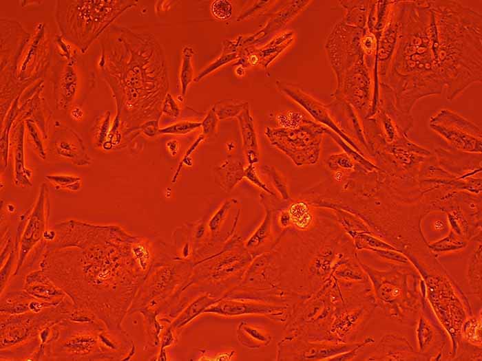 THLE-2人肝永生化细胞丨THLE-2细胞株