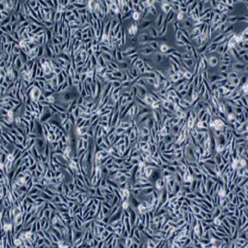 人前列腺癌细胞,DU145细胞