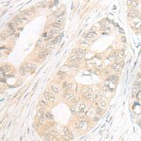 兔抗EBF2多克隆抗体