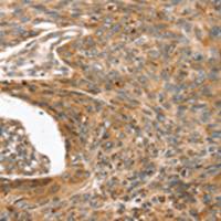 兔抗ERVW-1多克隆抗体