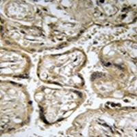 兔抗CST9L多克隆抗体