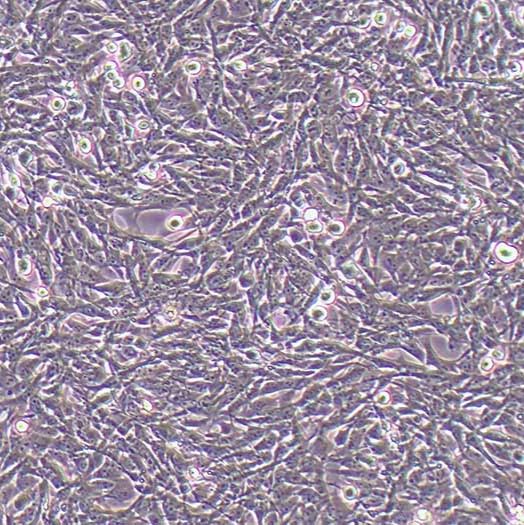 RMC-1大鼠视网膜muller细胞丨RMC-1细胞株