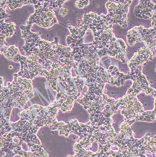ZR-75-1人乳腺癌细胞丨ZR-75-1细胞株丨逸漠(immocell)