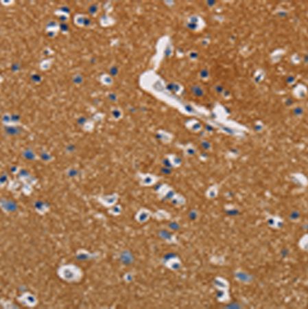 兔抗GPM6A多克隆抗体