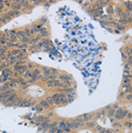 兔抗MMP8多克隆抗体