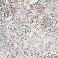 兔抗FERD3L多克隆抗体