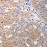 兔抗KRT6A/KRT6B/KRT6C多克隆抗体