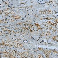 兔抗IL17RD多克隆抗体