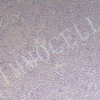 L-WRN小鼠皮下结缔组织细胞丨L-WRN细胞株