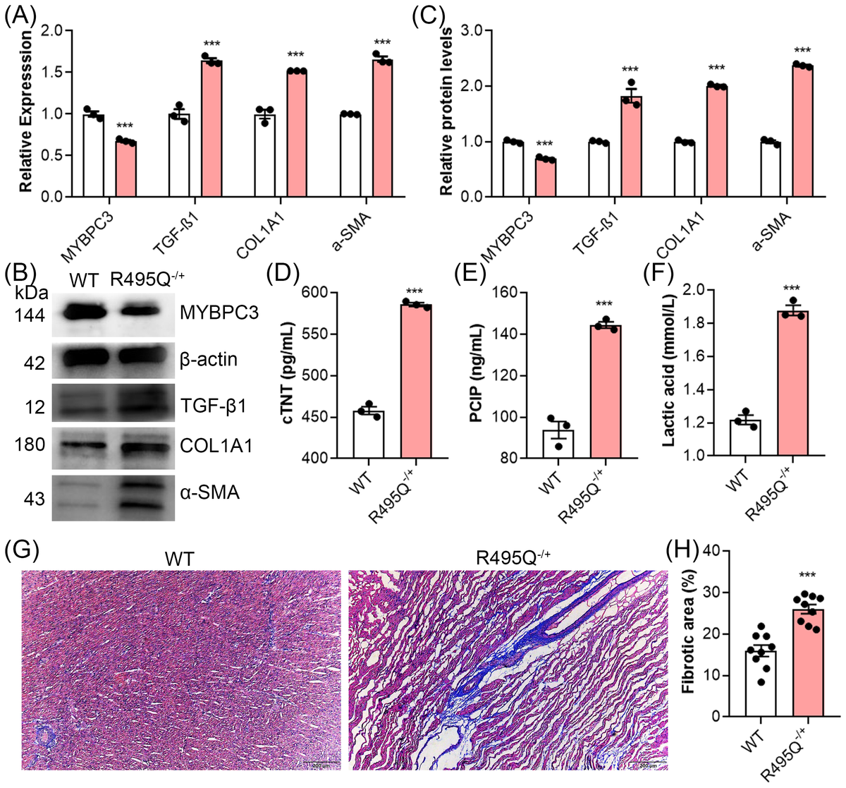 文献解读 | 通过基因编辑猪探索心肌纤维化发病机制！