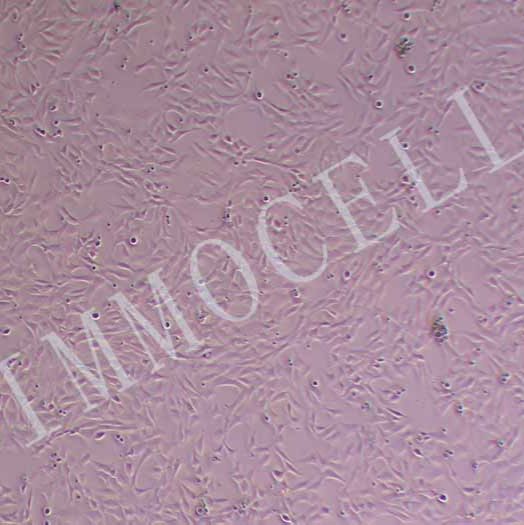 小鼠主动脉血管平滑肌细胞（永生化）