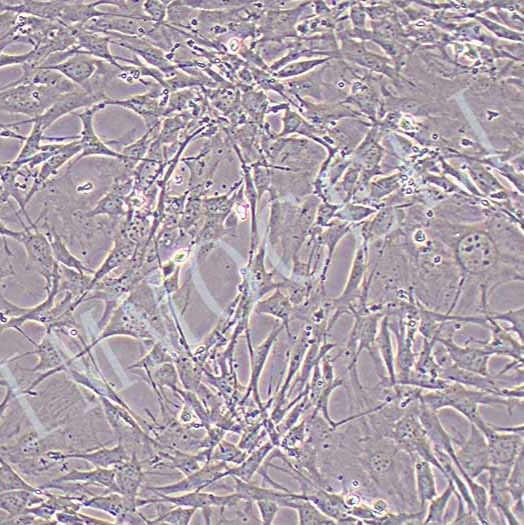 小鼠骨髓间充质干细胞（永生化）