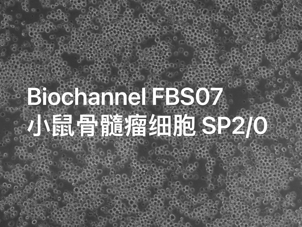 BioChannel血清培养—小鼠骨髓瘤细胞 SP2/0