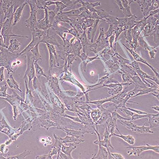 猪主动脉平滑肌细胞永生化丨逸漠(immocell)