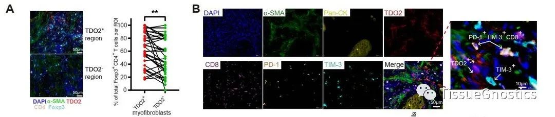 JCI | 中山大学北京大学联合揭示口腔肿瘤免疫逃逸机制和新的治疗靶点