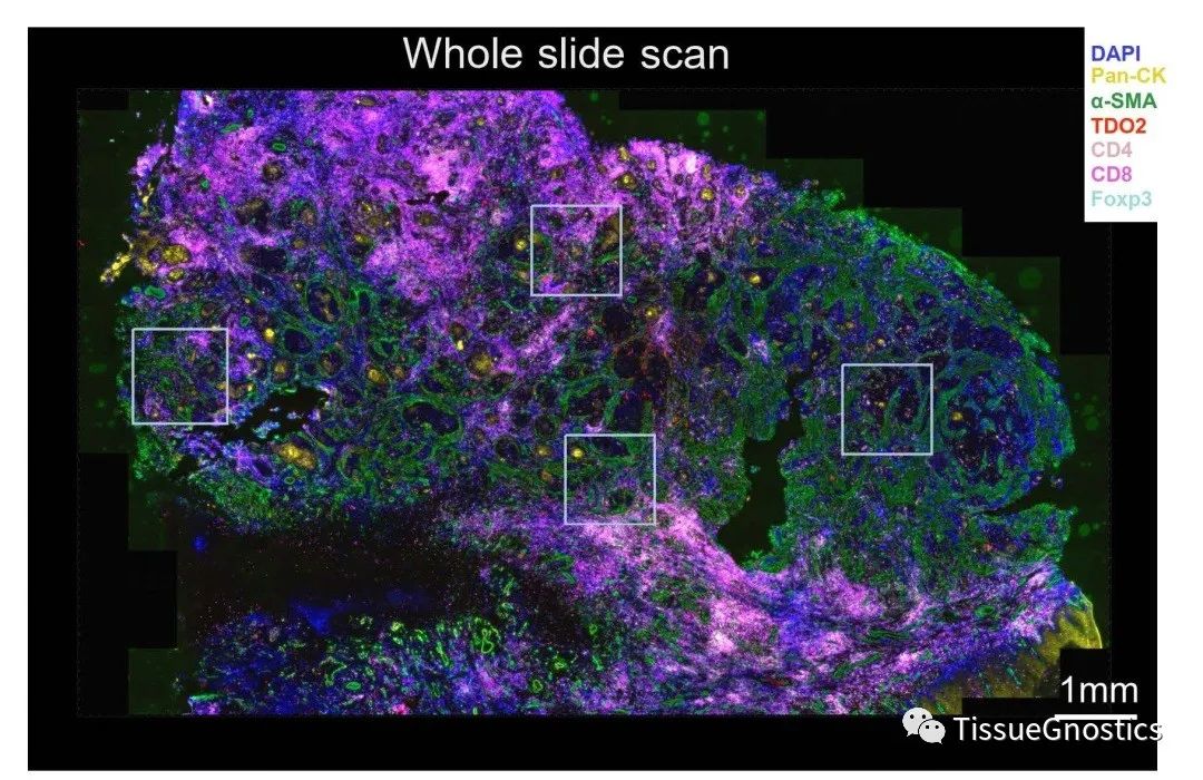 JCI | 中山大学北京大学联合揭示口腔肿瘤免疫逃逸机制和新的治疗靶点