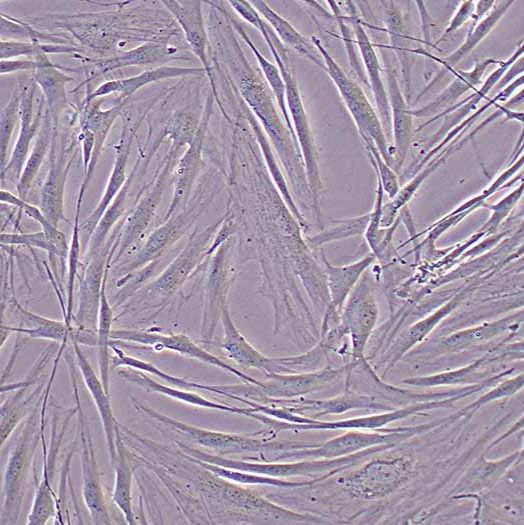 HSF人真皮成纤维细胞/hTERT转染/免疫荧光鉴定
