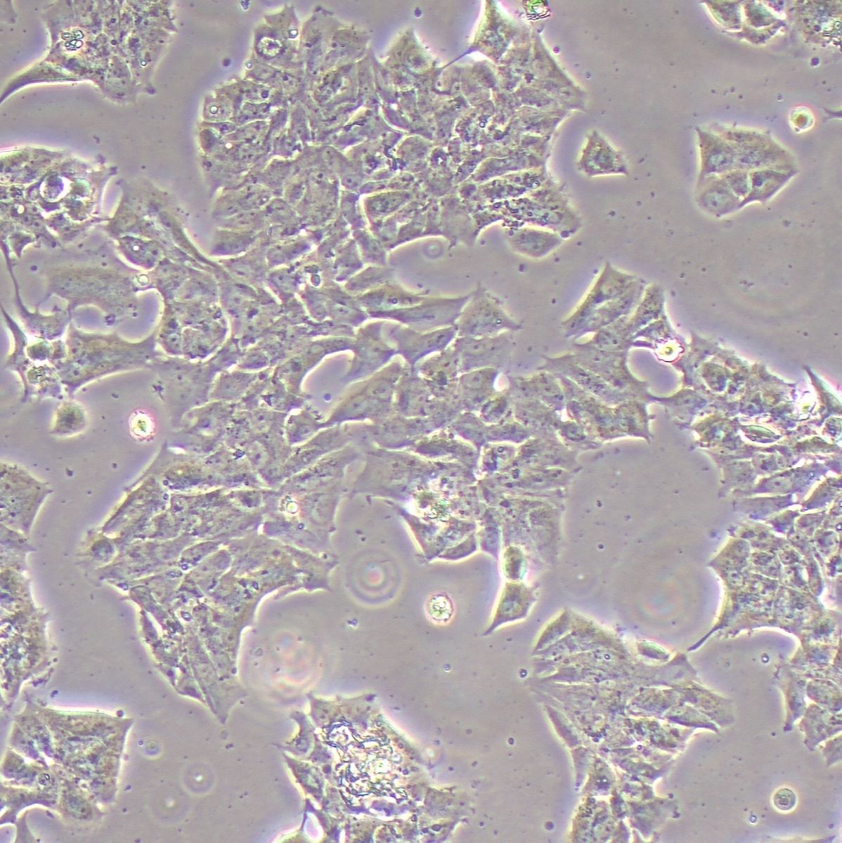 MDA-MB-361人乳腺癌细胞丨MDA-MB-361细胞系