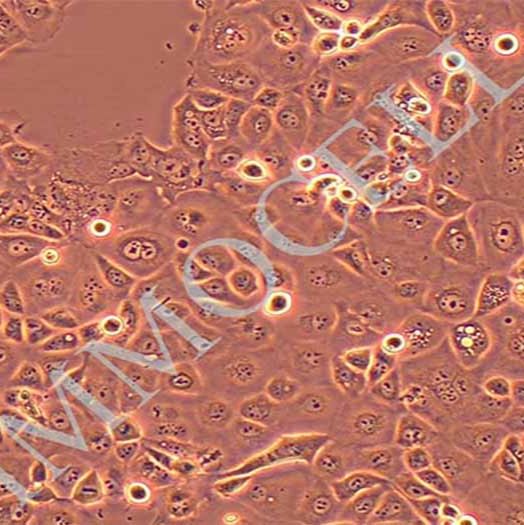NIH:OVCAR-3人卵巢癌腺癌细胞丨OVCAR3细胞株(STR图谱鉴定)